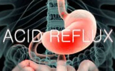 Anti-Reflux (GERD) Surgery