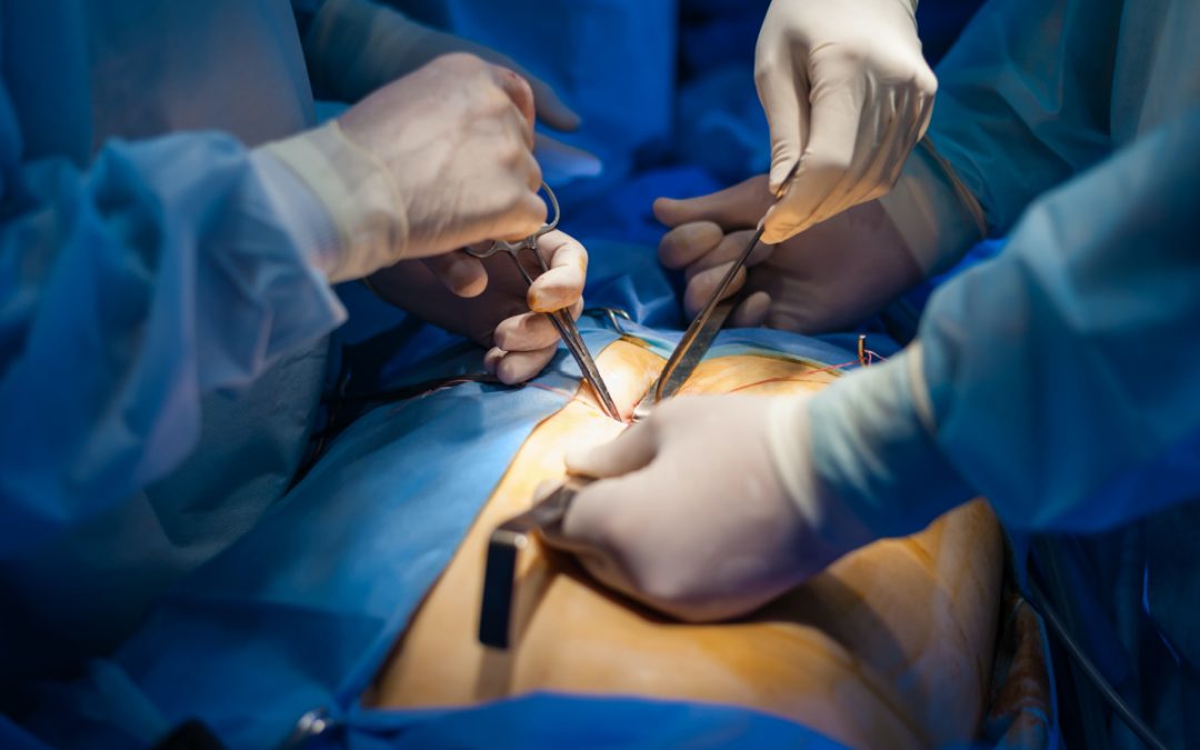 When Is Gallbladder Surgery Necessary and Can It Wait?