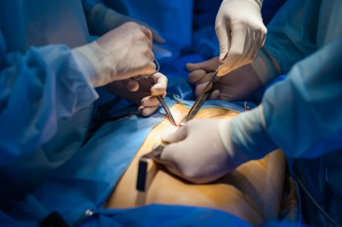 When Is Gallbladder Surgery Necessary and Can It Wait? - Scottsdale ...